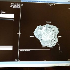 Donald the Lump 1600